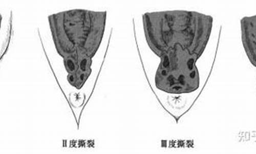 产后会阴部出现撕裂怎么治疗？