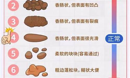 新生儿小便不正常怎么办？