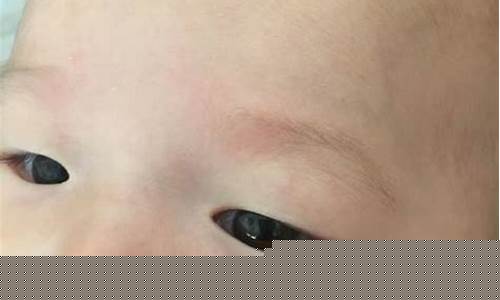 新生儿脸上有小红点是怎么回事？