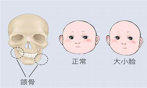 新生儿耳垂发育不完全怎么办？