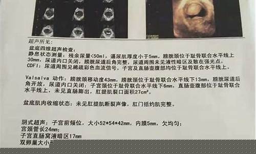 产后有没有必要进行全身检查？