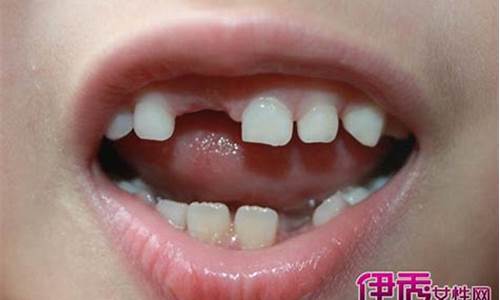 宝宝牙齿掉了怎么办？