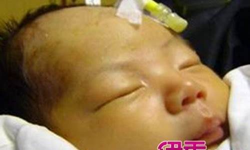 新生儿为什么会出现“喂养瓶依赖”？