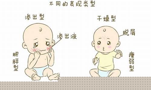 ﻿新生儿有奶疹怎么办？
